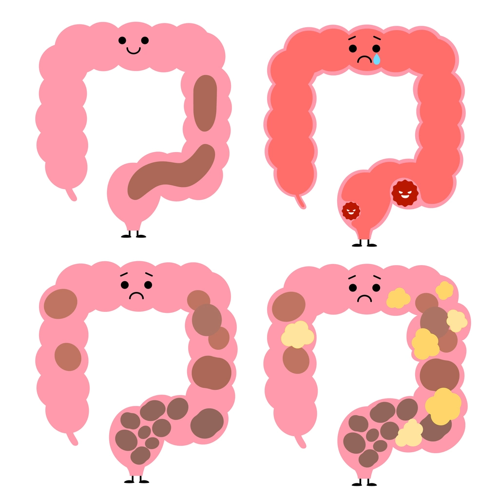 大腸
