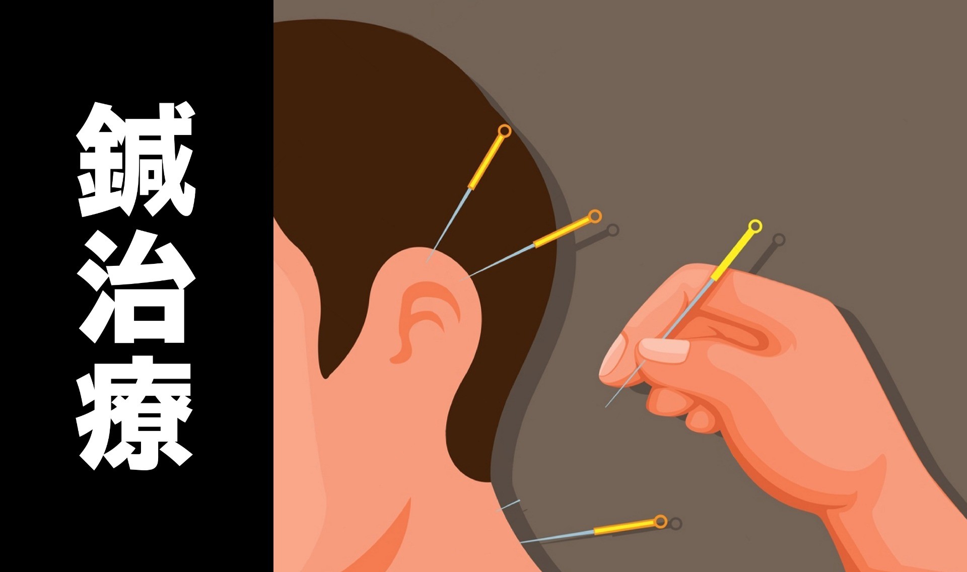 鍼治療