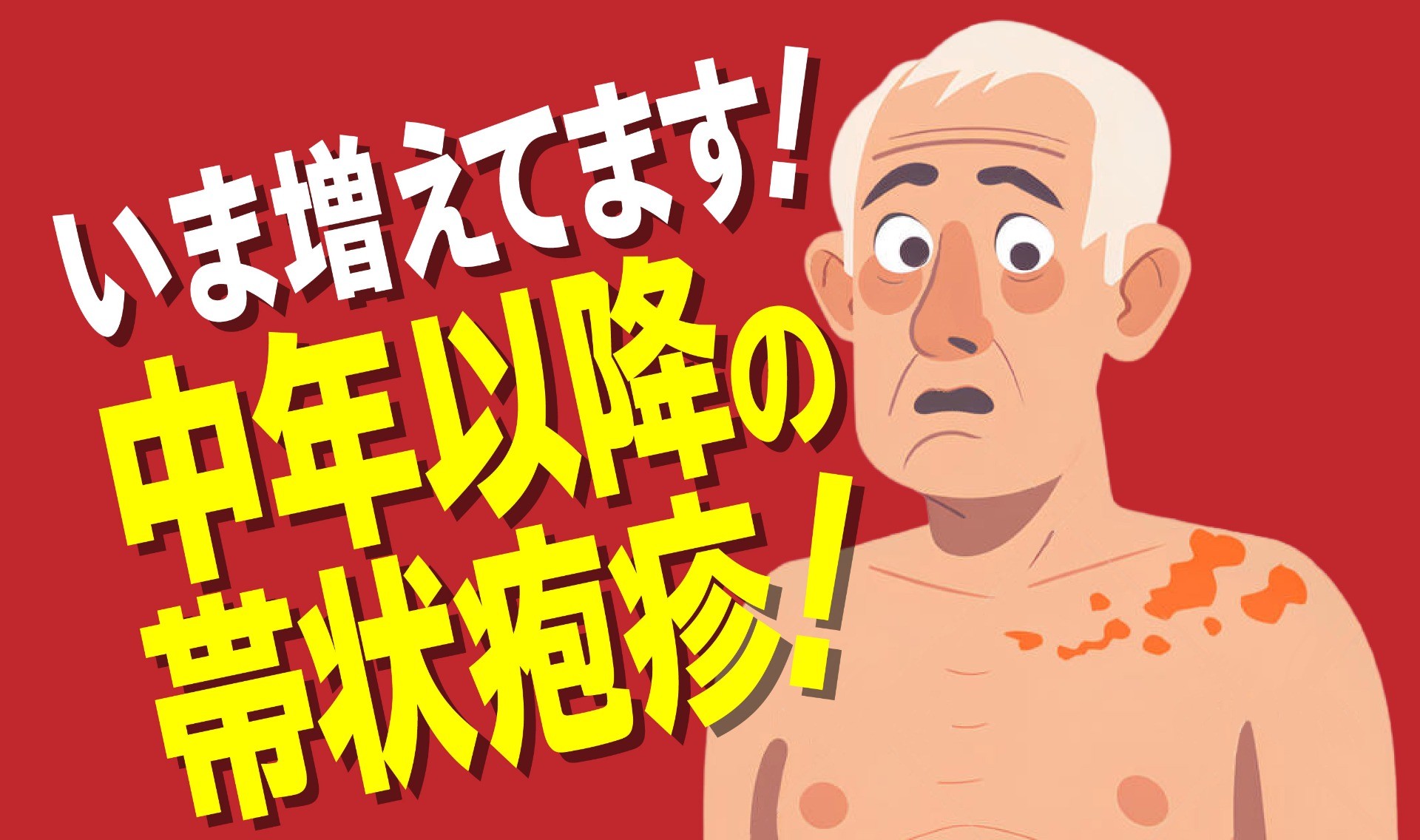 ワクチン接種で予防できる中年以降の帯状疱疹。