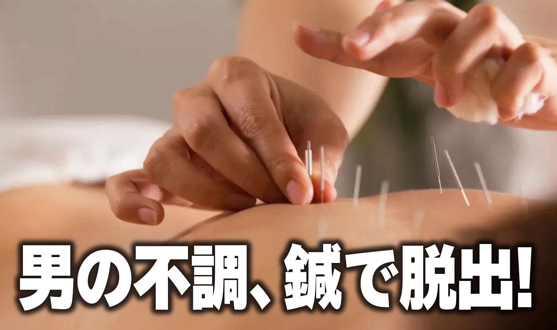 鍼治療