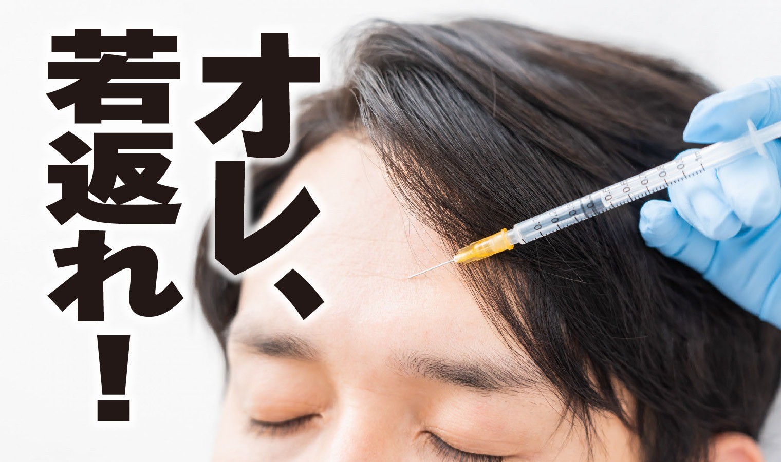 ボトックス